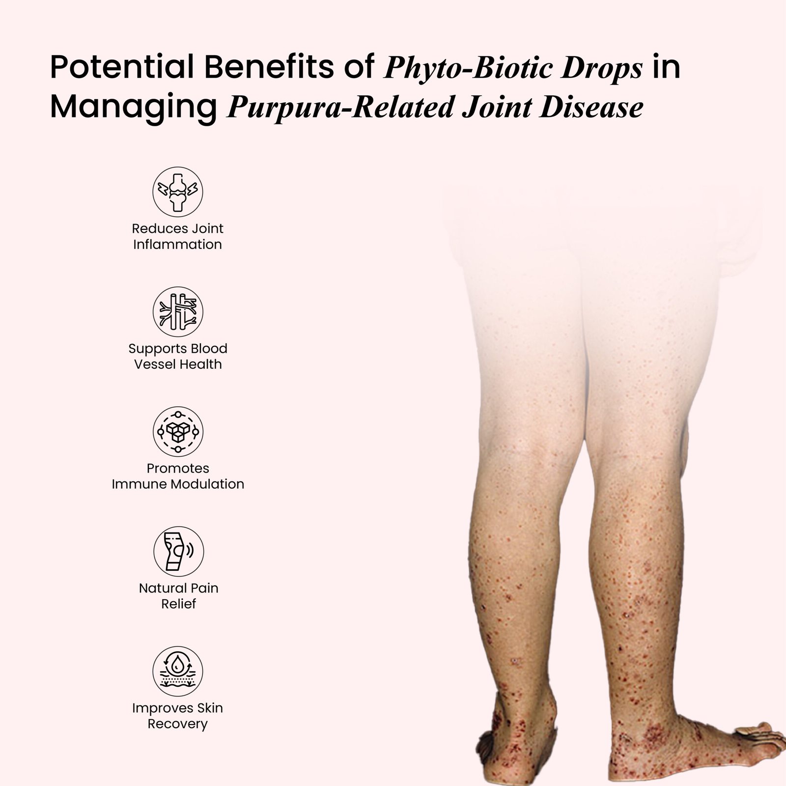 Blood & Lymphatic Disorders-07