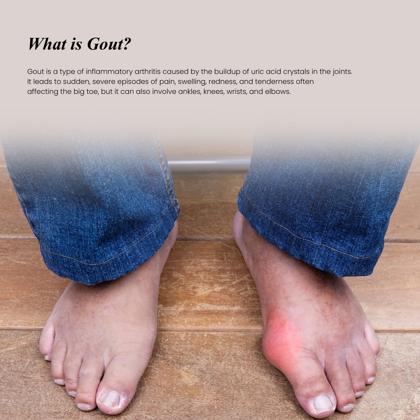 Musculoskeletal Disorders-14